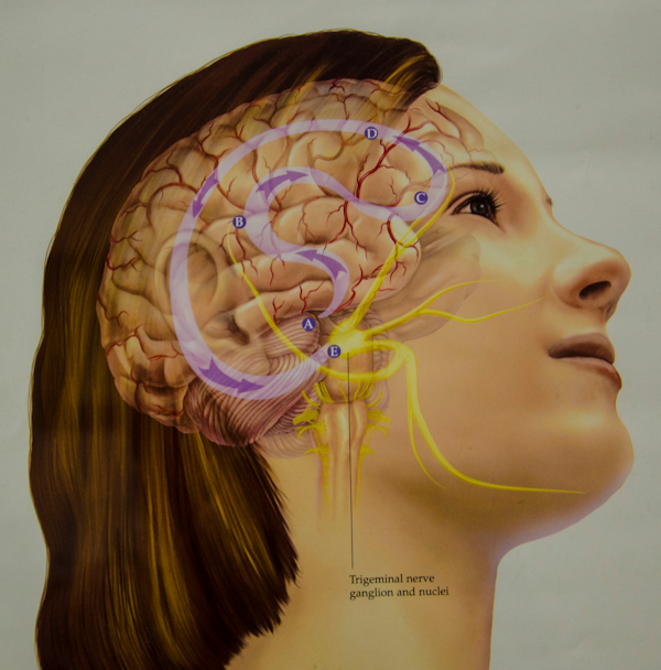 Valley Neurology - Understanding Migraine